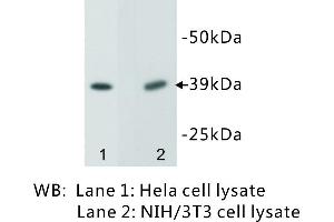 Image no. 3 for anti-Epithelial Cell Adhesion Molecule (EPCAM) antibody (ABIN1112808)