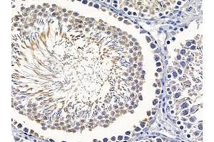 ABIN6258257 and ABIN6275216 at 1/100 staining rat testis tissue by IHC-P. (LSP1 抗体  (C-Term))