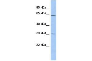 WB Suggested Anti-RAD9B Antibody Titration: 0. (RAD9B 抗体  (Middle Region))