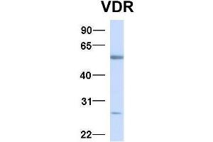 Host:  Rabbit  Target Name:  VDR  Sample Type:  Human Fetal Liver  Antibody Dilution:  1. (Vitamin D Receptor 抗体  (N-Term))