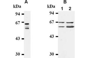 Western Blotting (WB) image for anti-Cell Division Cycle 25 Homolog A (S. Pombe) (CDC25A) antibody (ABIN487482) (CDC25A 抗体)