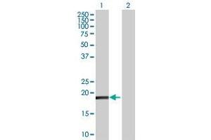 Lane 1: TNFSF18 transfected lysate ( 12.