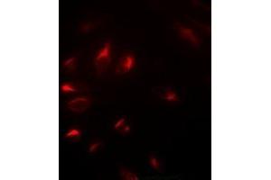 Immunofluorescent analysis of NELF-E staining in U2OS cells. (RDBP 抗体)