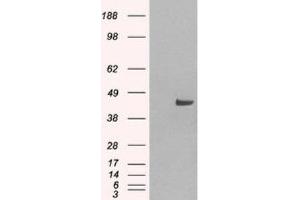 Western Blotting (WB) image for anti-Sorting Nexin 16 (SNX16) (N-Term) antibody (ABIN2466293) (SNX16 抗体  (N-Term))
