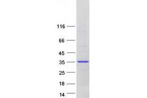 GS28 Protein (Transcript Variant 3) (Myc-DYKDDDDK Tag)