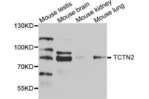 Western blot analysis of extract of various cells, using TCTN2 antibody. (TCTN2 抗体)