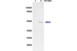 Lane 1: rat brain lysates Lane 2: human colon carcinoma lysates probed with Anti MAGEA11 Polyclonal Antibody, Unconjugated (ABIN721285) at 1:200 in 4 °C. (MAGEA11 抗体  (AA 12-120))