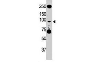 The Tlr5 polyclonal antibody  is used in Western blot to detect TLR5 in HL-60 cell lysate. (TLR5 抗体  (C-Term))
