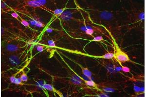 Mixed rat neuron-glial cultures stained with ABIN1842228, polyclonal antibody to -synuclein (red) and monoclonal antibody to MAP2: MAP2-4H5 (green). (SNCA 抗体)