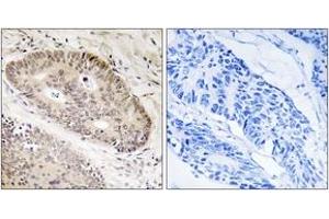 Immunohistochemistry (IHC) image for anti-Calcium Responsive Transcription Factor (CARF) (AA 311-360) antibody (ABIN2890117) (Calcium Responsive Transcription Factor (CARF) (AA 311-360) 抗体)