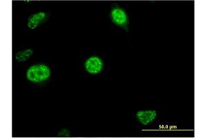 Immunofluorescence of monoclonal antibody to CDC20B on HeLa cell. (CDC20B 抗体  (AA 416-515))