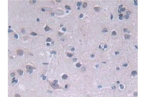 Immunohistochemistry (IHC) image for anti-Fatty Acid Desaturase 2 (FADS2) (AA 1-130) antibody (ABIN7436027)