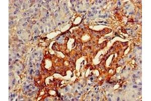 Immunohistochemistry of paraffin-embedded human pancreatic tissue using ABIN7154660 at dilution of 1:100 (VAV3 抗体  (AA 562-674))