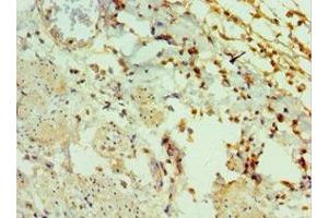 Immunohistochemistry of paraffin-embedded human epityphlon tissue using ABIN7153430 at dilution of 1:100 (GAL 抗体  (AA 20-123))