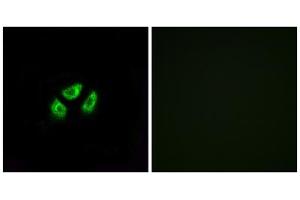 Immunofluorescence analysis of A549 cells, using SCN7A antibody. (SCN7A 抗体  (Internal Region))