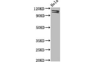 Western Blot Positive WB detected in: Hela whole cell lysate All lanes: UBA1 antibody at 2 μg/mL Secondary Goat polyclonal to rabbit IgG at 1/50000 dilution Predicted band size: 118, 114 kDa Observed band size: 118, 114 kDa (UBA1 抗体  (AA 730-881))
