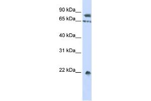WB Suggested Anti-SENP1 Antibody Titration: 0. (SENP1 抗体  (Middle Region))