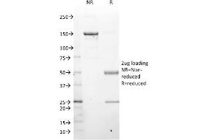 Western Blotting (WB) image for anti-LIM Domain Only 2 (Rhombotin-Like 1) (LMO2) (AA 23-140) antibody (ABIN6939966)