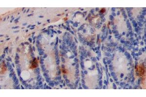 Immunohistochemistry (IHC) image for anti-5-Hydroxytryptamine (5-HT) antibody (ABIN7429649)