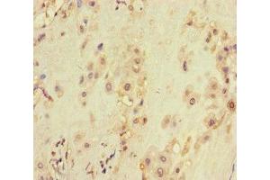 Immunohistochemistry (IHC) image for anti-Voltage-Dependent Anion Channel 2 (VDAC2) (AA 2-36) antibody (ABIN7175563)