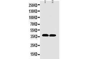 Anti-MTCO1 antibody,  Western blotting Lane 1: Rat Heart Tissue Lysate Lane 2: Mouse Heart Tissue Lysate (COX1 抗体  (N-Term))