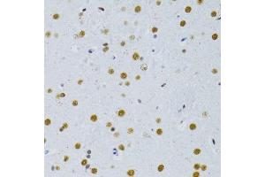 Immunohistochemistry of paraffin-embedded rat brain using SNRNP70 antibody. (SNRNP70 抗体  (AA 150-250))