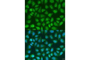Immunofluorescence analysis of U2OS cells using SOCS4 antibody. (SOCS4 抗体  (AA 1-270))