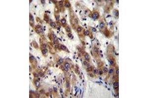 Immunohistochemistry analysis in formalin fixed and paraffin embedded human liver tissue reacted with PHF20 Antibody (N-term) followed which was peroxidase conjugated to the secondary antibody and followed by DAB staining. (PHF20 抗体  (N-Term))