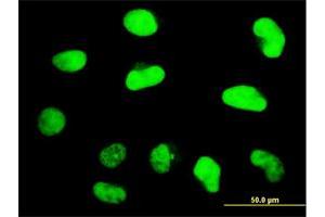 Immunofluorescence of monoclonal antibody to ZNF207 on HeLa cell. (ZNF207 抗体  (AA 1-110))