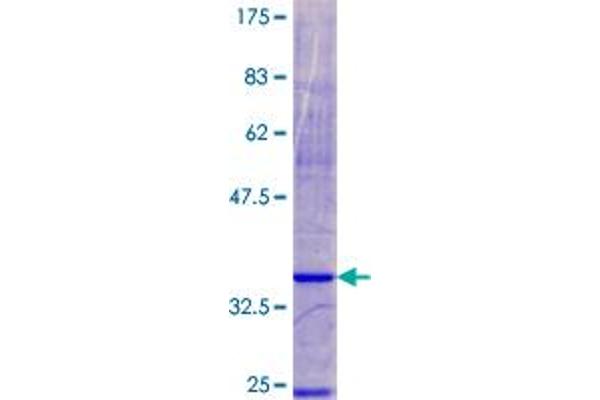 NDUFA3 Protein (AA 1-84) (GST tag)