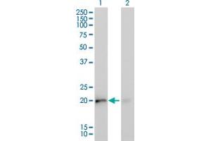 Western Blot analysis of KRAS expression in transfected 293T cell line by KRAS monoclonal antibody (M02), clone 4F3. (K-RAS 抗体  (AA 16-125))