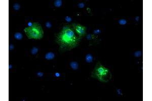 Image no. 2 for anti-Lysophosphatidic Acid Receptor 1 (LPAR1) antibody (ABIN1499191) (LPAR1 抗体)