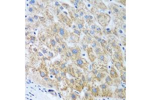 Immunohistochemistry of paraffin-embedded human liver using UBE2U antibody (ABIN6130858, ABIN6149825, ABIN6149826 and ABIN6224418) at dilution of 1:100 (40x lens). (UBE2U 抗体  (AA 1-226))