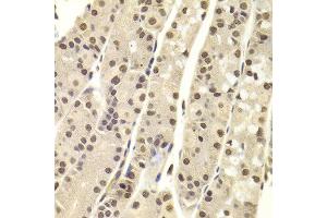 Immunohistochemistry of paraffin-embedded Human gastric using DNTT antibody at dilution of 1:100 (x400 lens). (TdT 抗体)
