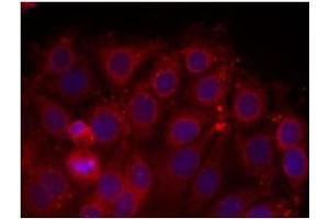 Image no. 2 for anti-VEGF Receptor 2 (VEGFR2) (Tyr1175) antibody (ABIN197237) (VEGFR2/CD309 抗体  (Tyr1175))
