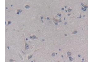 Detection of MEAI in Human Cerebrum Tissue using Polyclonal Antibody to Menin (MEAI) (Menin 抗体  (AA 219-395))