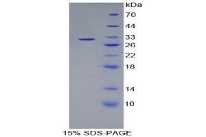 SDS-PAGE (SDS) image for Kallikrein 1 (KLK1) (AA 21-261) protein (His tag) (ABIN1980873)