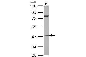 Western Blotting (WB) image for anti-Guanine Nucleotide Binding Protein (G Protein), alpha Inhibiting Activity Polypeptide 2 (GNAI2) (Center) antibody (ABIN2855168)