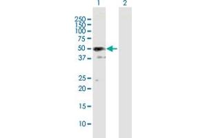 Western Blot analysis of SH3GLB2 expression in transfected 293T cell line by SH3GLB2 MaxPab polyclonal antibody. (SH3GLB2 抗体  (AA 1-395))