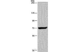 Western blot analysis of K562 cell, using ZC3H12A Polyclonal Antibody at dilution of 1:200 (ZC3H12A 抗体)