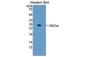 Western Blotting (WB) image for anti-Cytochrome P450, Family 26, Subfamily A, Polypeptide 1 (CYP26A1) (AA 73-255) antibody (ABIN1862405)