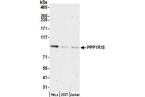 anti-KIAA1949 (KIAA1949) (AA 375-425) antibody