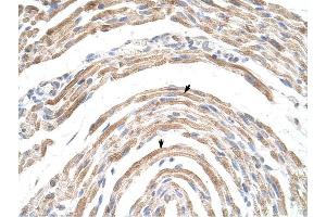 Immunohistochemistry (IHC) image for anti-Cleavage and Polyadenylation Specific Factor 6, 68kDa (CPSF6) (Middle Region) antibody (ABIN630020)