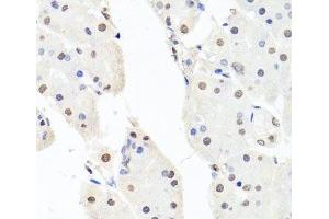 Immunohistochemistry of paraffin-embedded Human stomach using CHRAC1 Polyclonal Antibody at dilution of 1:100 (40x lens). (CHRAC1 抗体)