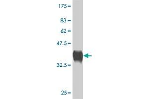 Western Blot detection against Immunogen (37. (Corin 抗体  (AA 616-715))