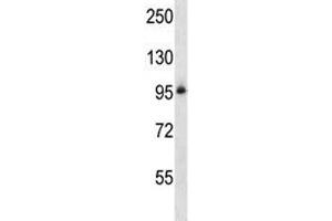 Integrin beta 5 antibody western blot analysis in NCI-H460 lysate. (Integrin beta 5 抗体  (AA 216-244))