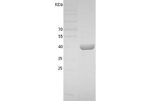 Western Blotting (WB) image for Plasminogen Activator Inhibitor 1 (SERPINE1) (AA 24-402) protein (His tag) (ABIN7124465) (PAI1 Protein (AA 24-402) (His tag))