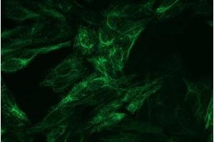 Immunocytochemistry staining of cytokeratin 8 in Hep-2 cells using mouse monoclonal C-43 (ABIN94300, diluted 1:100), detected with GAM IgG-Alexa Fluor®488 (diluted 1:200; green). (KRT8 抗体)