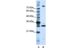 Western Blotting (WB) image for anti-serine/arginine-Rich Splicing Factor 10 (SRSF10) antibody (ABIN2462321)