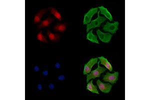 ABIN7093407 and ABIN7097429 staining Hela cells by IF/ICC. (CRTC2 抗体)